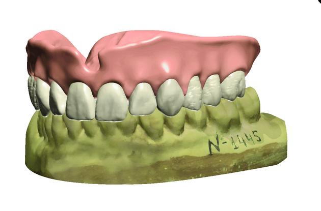Dental System 牙科修復軟體 1