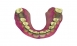 Dental System 牙科修復軟體