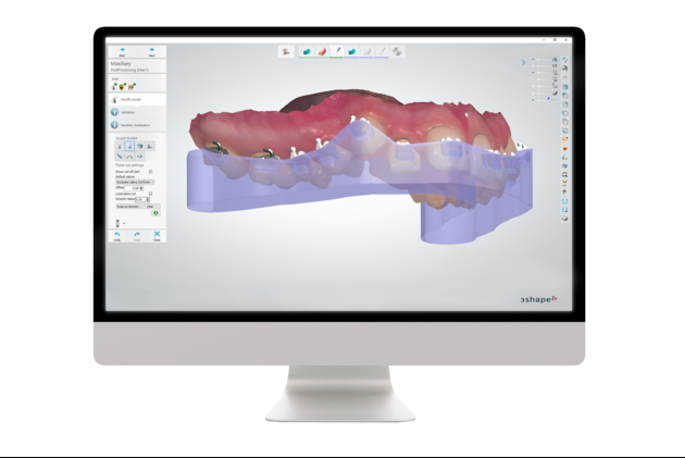 Ortho Analyzer 專業矯正軟體 2