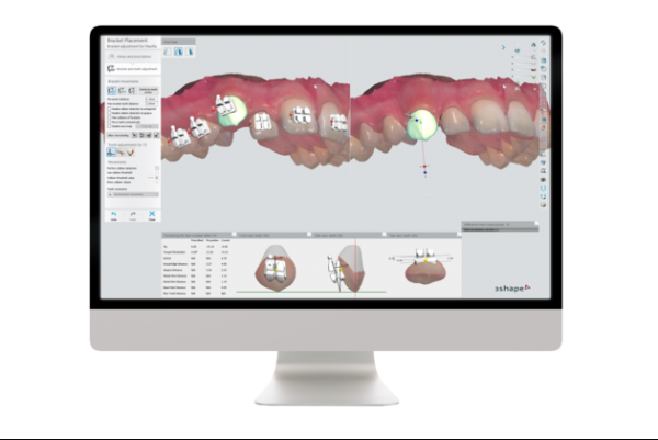 Ortho Analyzer 專業矯正軟體